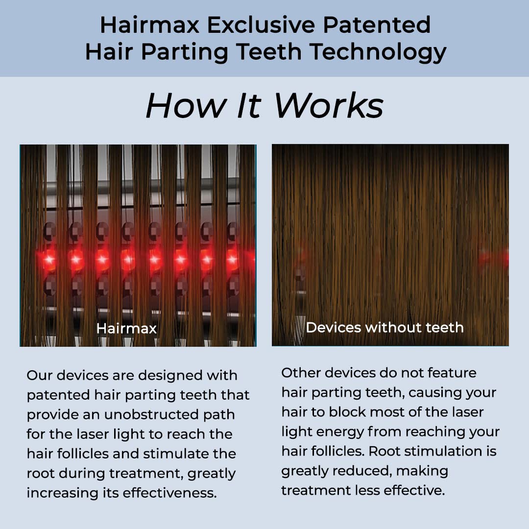 Foto 7 | Dispositivo Para El Crecimiento Del Cabello Hairmax Ultima 9 Classic Lasercomb - Venta Internacional.