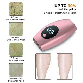 Foto 4 | Depiladora Ipl, Láser Permanente, 600.000 Flashes, Profesional - Venta Internacional.