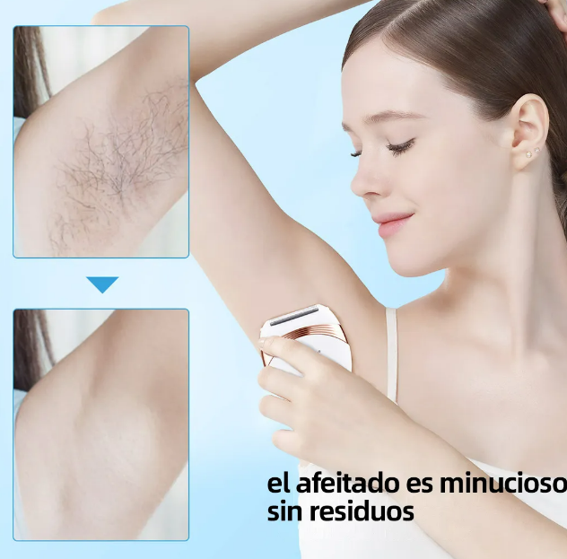Foto 4 | Depiladora Corporal Xtellar Portátil