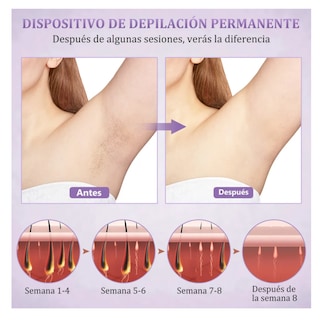 Foto 3 | Depiladora Láser Corporal Modo Frio Color Violeta 127v, Lab.g