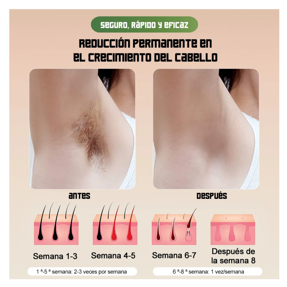 Foto 3 pulgar | Depiladora de Pulsada Permanente Láser Belug Blanca