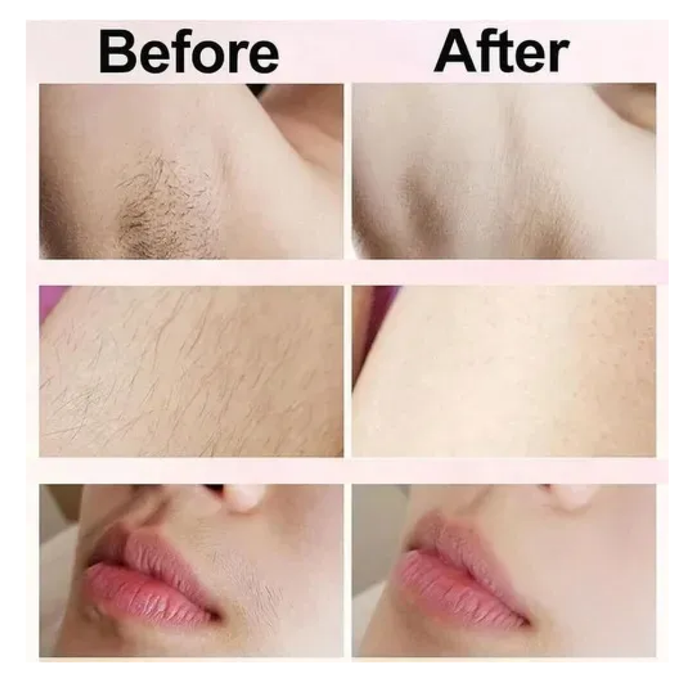 Foto 4 | Depiladora De Bikini Para Mujer Eléctrica Doble Cabeza 2in1 Lab.g  Rosa