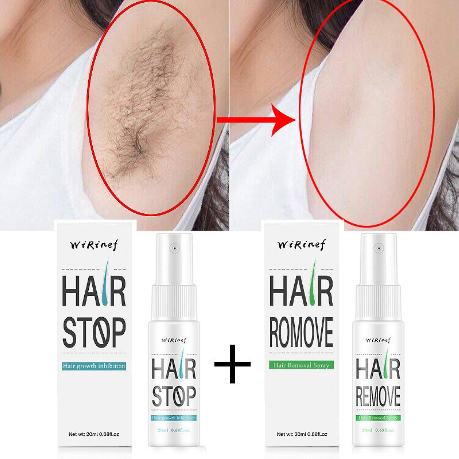 Foto 3 pulgar | Spray Depilatorio Huoguo Contra El Crecimiento Del Vello Para Hombres Y Mujeres - Venta Internacional.