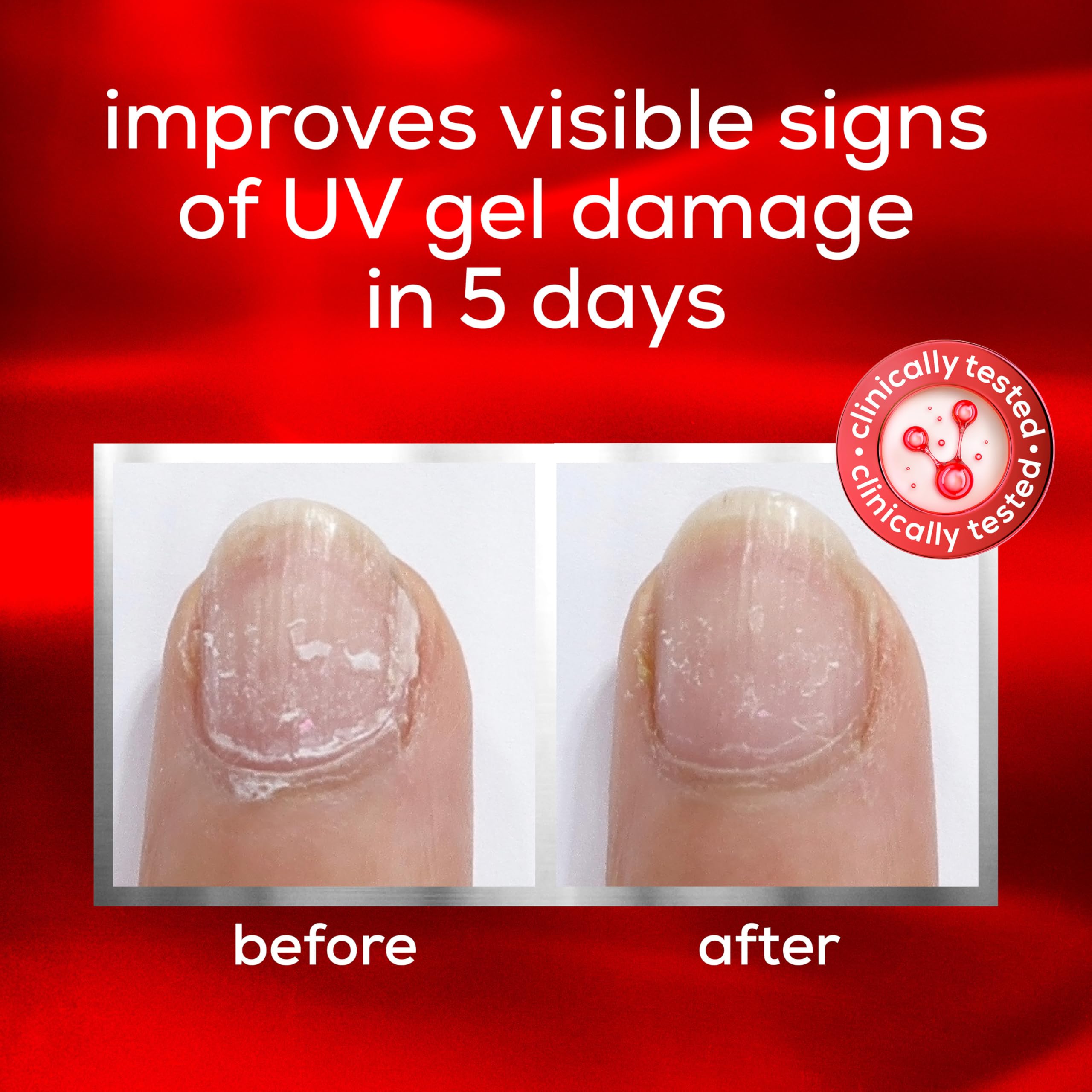 Foto 4 pulgar | Tratamiento De Uñas Essie Uv Gel Damage Repair, 13,6 Ml - Venta Internacional.