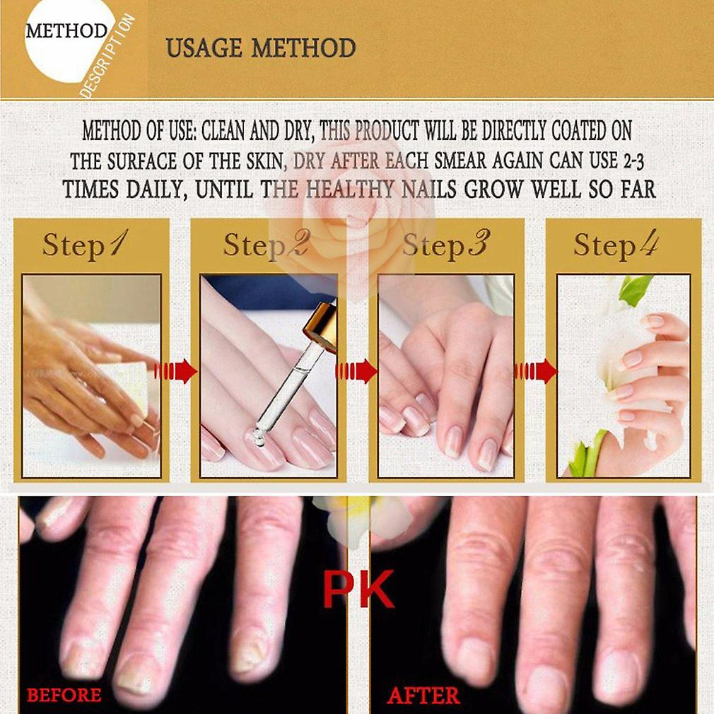 Foto 1 | Esencia Activa Para Uñas Meiyanqiong Herbaceous Energy, 30 Ml - Venta Internacional.