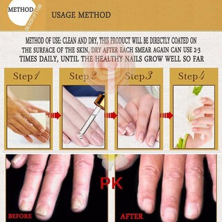 Foto 1 | Esencia Activa Para Uñas Meiyanqiong Herbaceous Energy, 30 Ml - Venta Internacional.