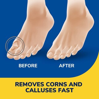 Foto 3 | Eliminador Líquido De Maíz Y Callos Dr. Scholl's, 10 Ml, Con Cojines - Venta Internacional.