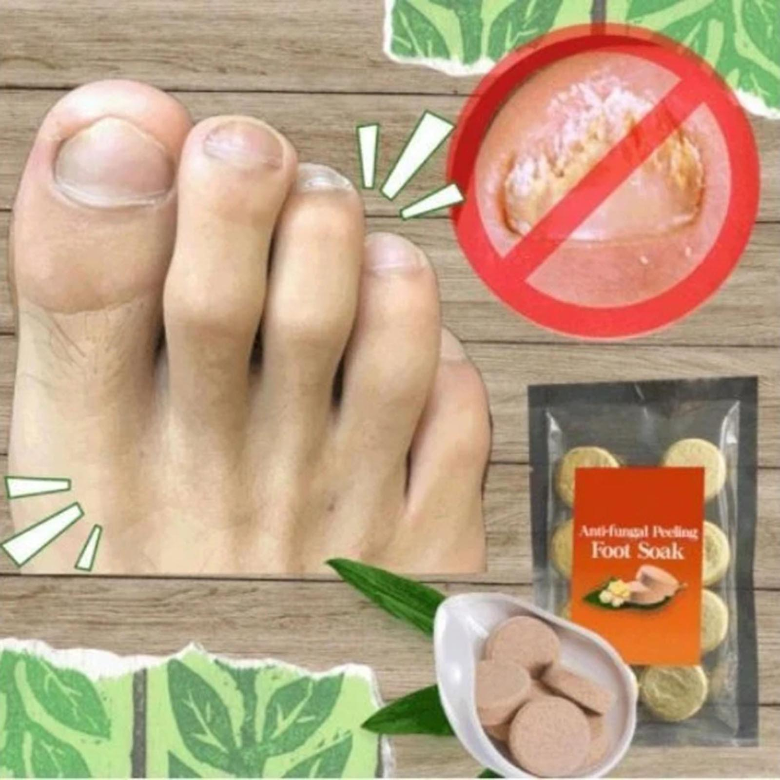 Foto 3 pulgar | Tabletas Para Remojar Los Pies Huoguo  Exfoliantes Antimicóticos  Cuidado De Los Pies - Venta Internacional.