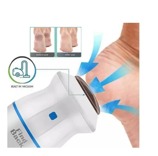 Foto 3 pulgar | Amoladora Eléctrica Para Pies, Removedor De Callos, X2, Con Recarga Usb - Venta Internacional.
