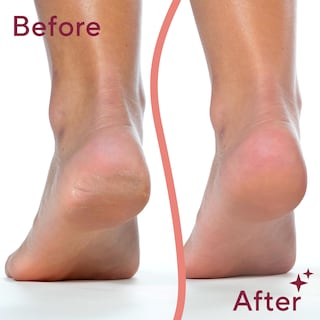 Foto 4 | Herramienta Electrónica De Pedicura, Lima Y Eliminador De Callos, Flawless Pedi - Venta Internacional.