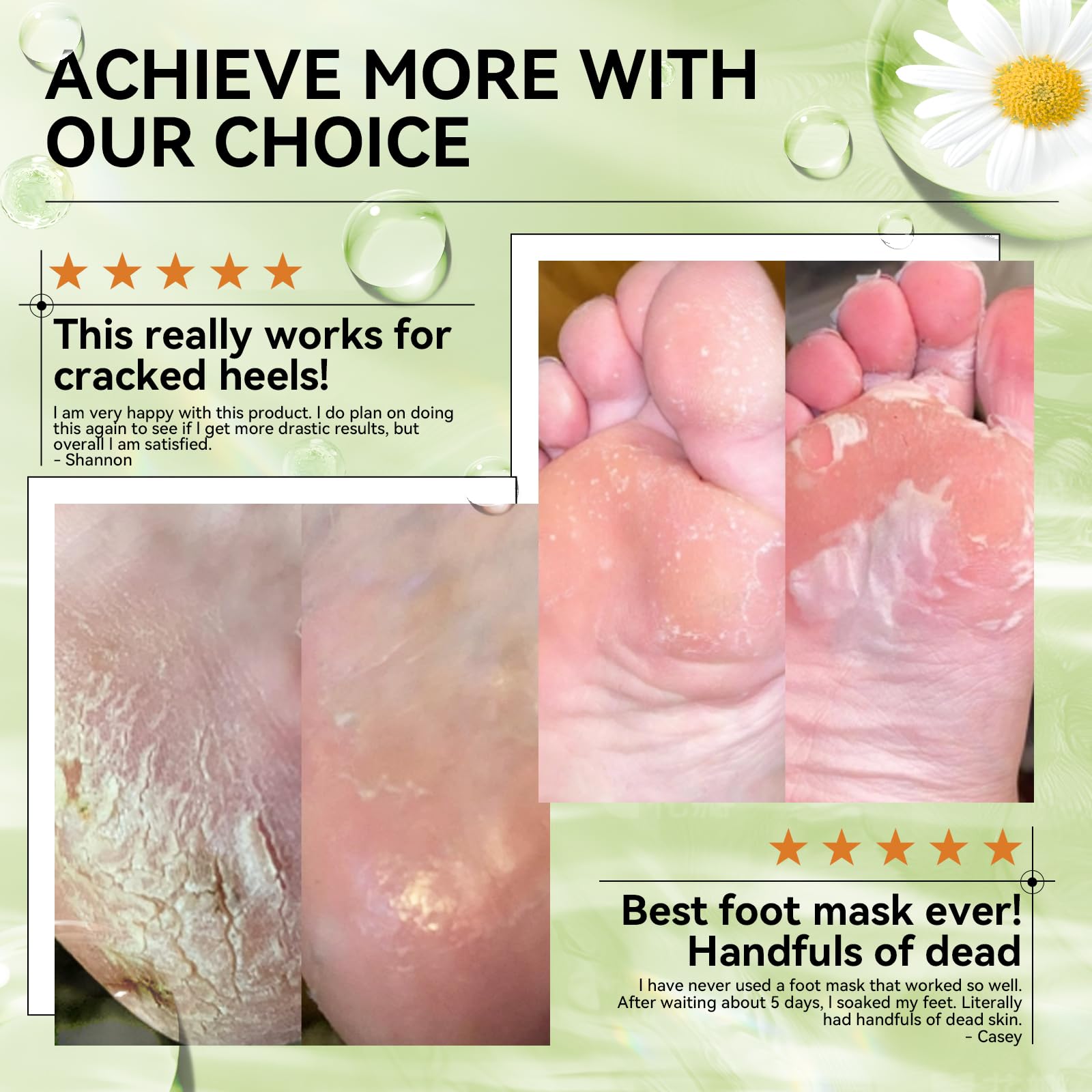 Foto 4 pulgar | Mascarilla Exfoliante Para Pies Lanbena Aloe Vera Para Pies Secos Y Agrietados - Venta Internacional.