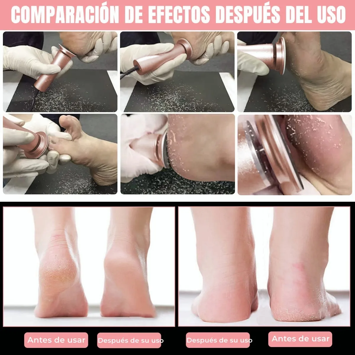 Foto 5 pulgar | Lima Eléctrica Pies, Removedor De Callo Profesional Exfoliado Lab.g Rosa
