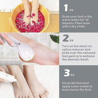 Foto 3 | Herramienta Eléctrica Para El Cuidado De Los Pies Para Eliminar Callos Con Aspiradora Huoguo - Venta Internacional.