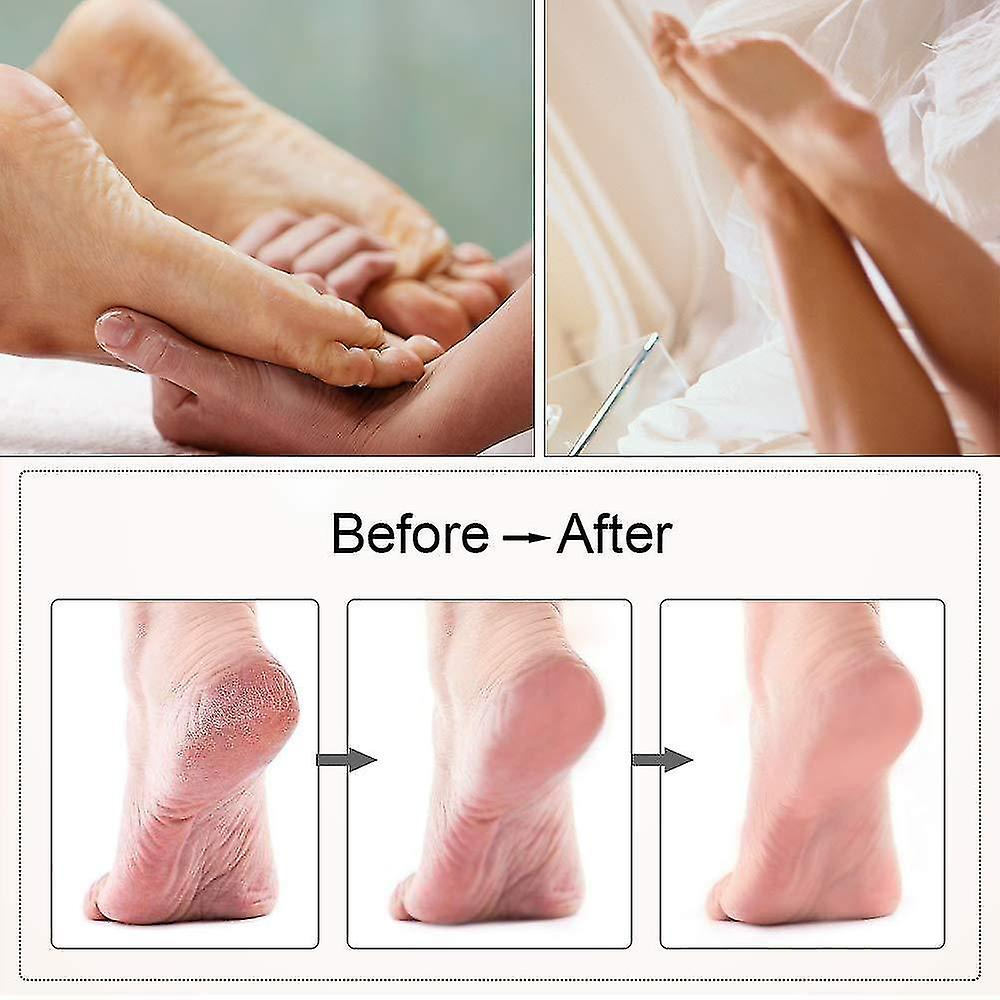 Foto 4 pulgar | Herramienta Eléctrica Para Pedicura Con Lima Para Pies Huoguo  Usb De Tres Velocidades - Venta Internacional.