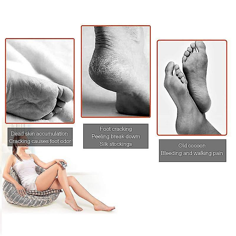 Foto 6 pulgar | Amoladora Eléctrica Para Limas De Pies  Herramienta Usb Para Limpieza De Pies  Removedor De Callos - Venta Internacion