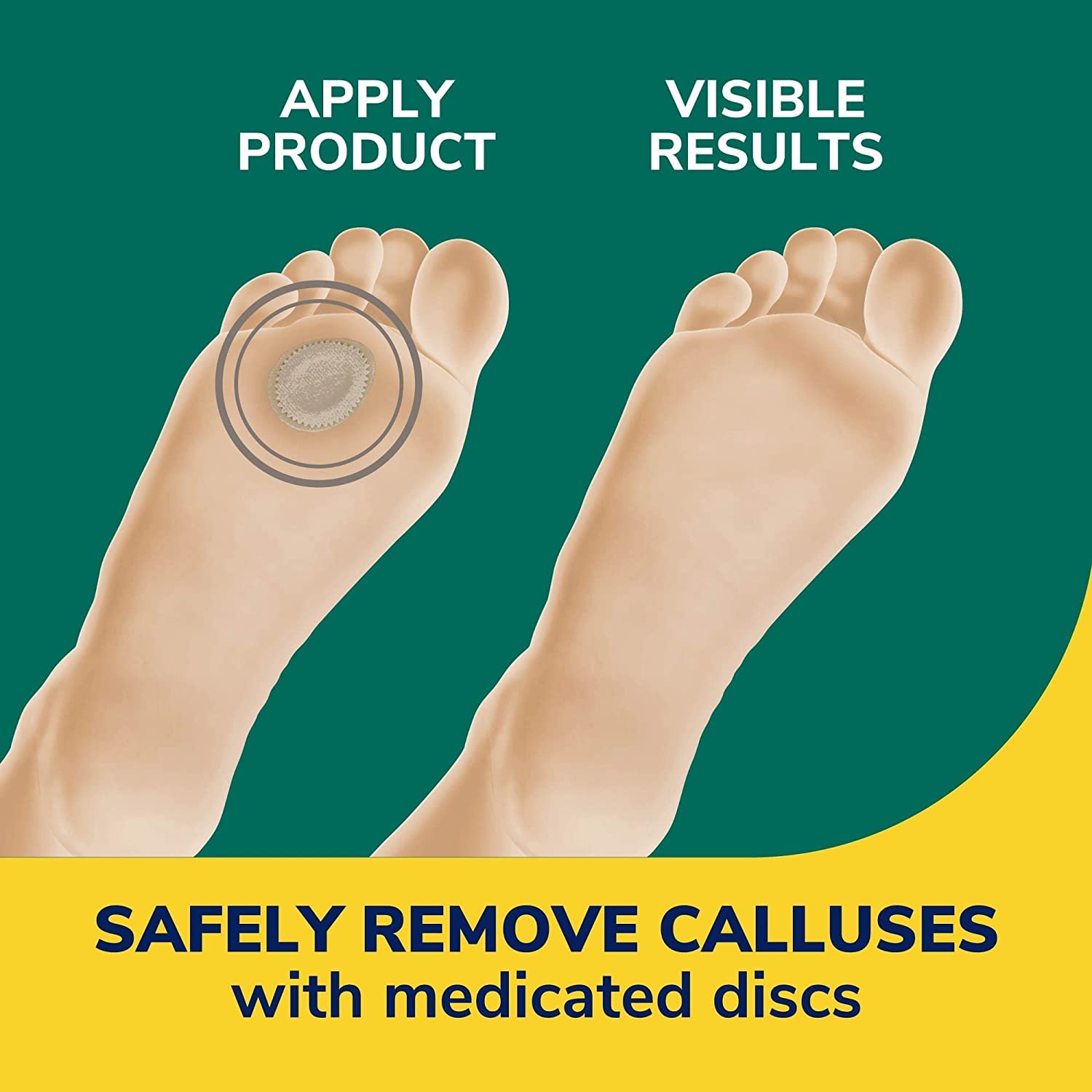Foto 4 pulgar | Eliminador De Callos Dr. Scholl's  Extragrueso  4 Unidades (paquete De 2) - Venta Internacional.