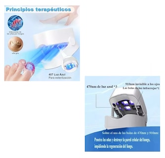 Foto 2 | Laser Para Quitar Hongos De Las Uñas Elimina Onicomicosis Blanco