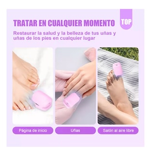 Foto 5 | Tratamiento Láser De Hongos En Las Uñas Y Onicomicosis Rosa