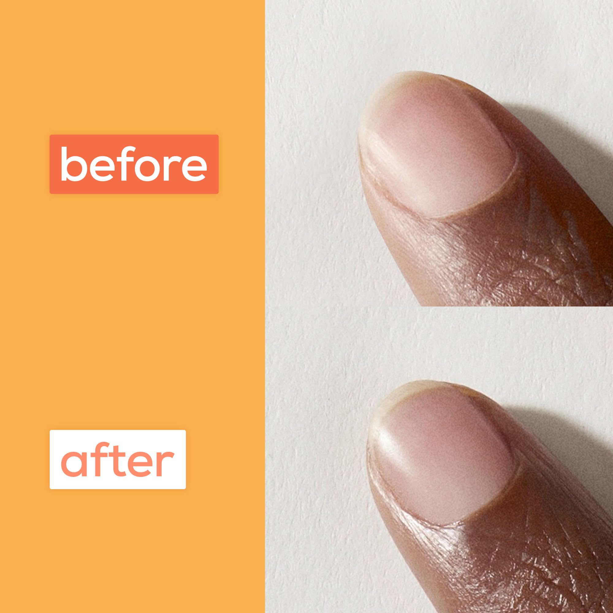 Foto 7 pulgar | Aceite Y Tratamiento Para Cutículas De Albaricoque Essie Para Cuidado De Uñas, 13 Ml, 8 Unidades - Venta Internacional.