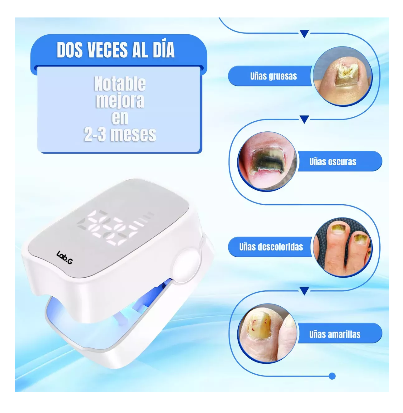 Foto 5 pulgar | Laser Para Quitar Hongos De Las Uñas Elimina Onicomicosis Blanco