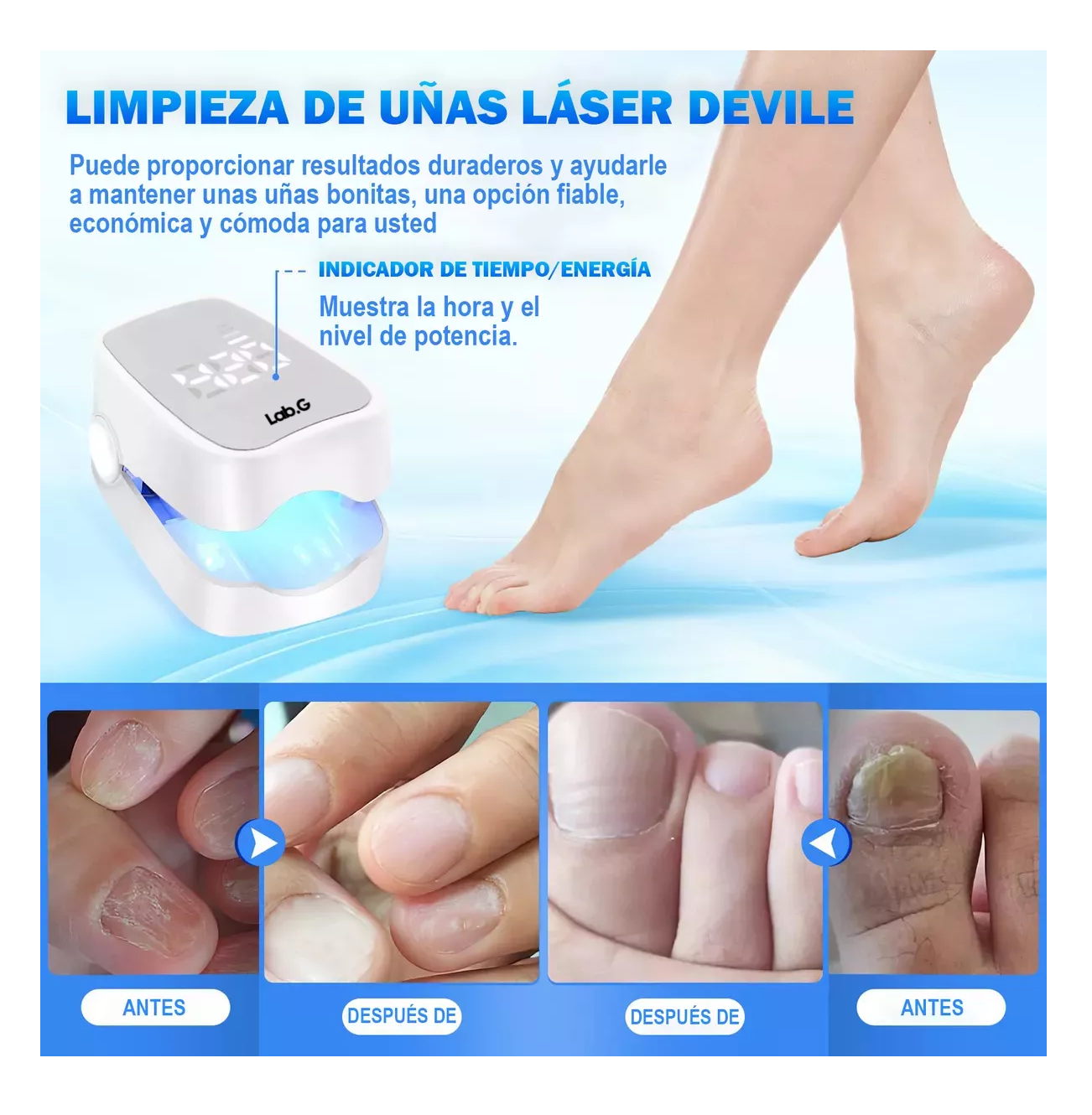 Foto 6 pulgar | Laser Para Quitar Hongos De Las Uñas Elimina Onicomicosis Blanco