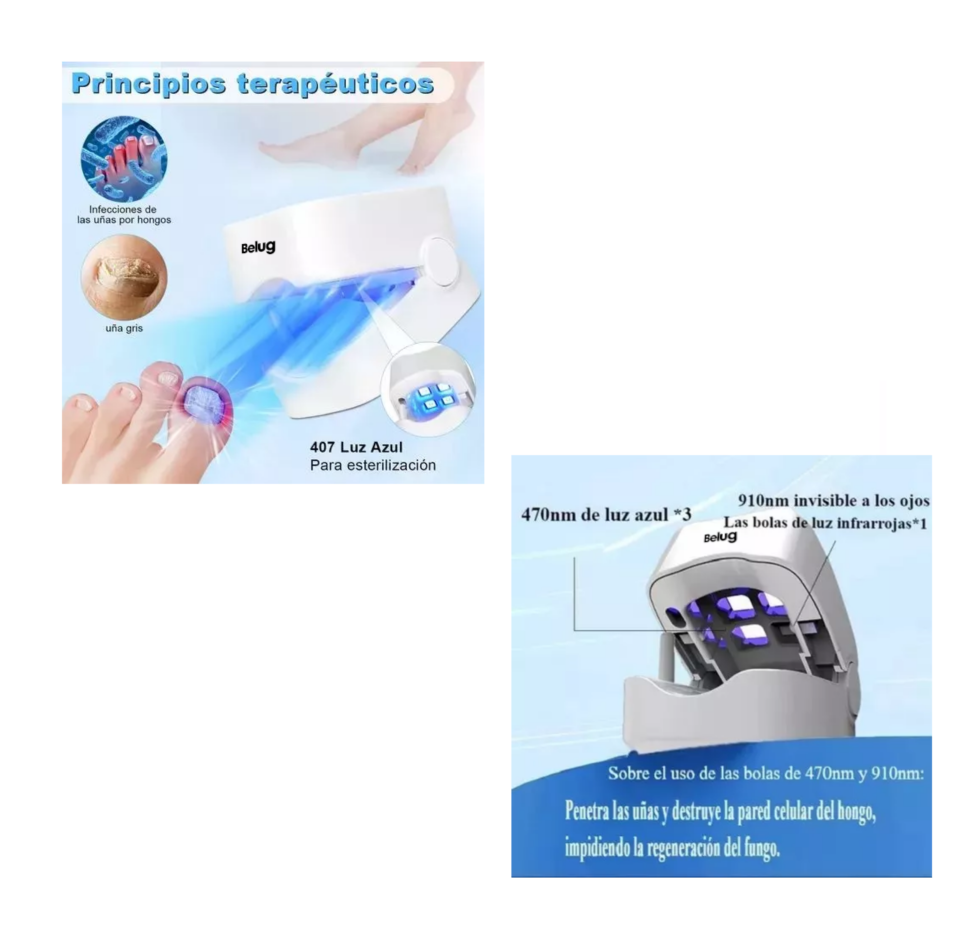 Foto 2 | Laser Para Quitar Hongos De Las Uñas Elimina Onicomicosis Blanco Belug