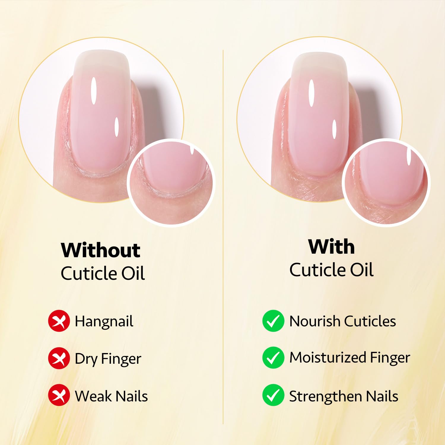 Foto 4 | Aceite Para Cutículas Gaoy, Fortalecedor De Cuidado De Cutículas, 20 Ml, Para El Crecimiento De Las Uñas - Ven