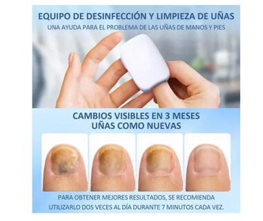 Foto 2 | Laser Para Tratamiento Remedio Hongos Unas Onicomicosis