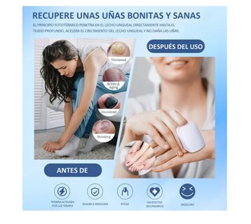 Foto 3 | Laser Para Tratamiento Remedio Hongos Unas Onicomicosis