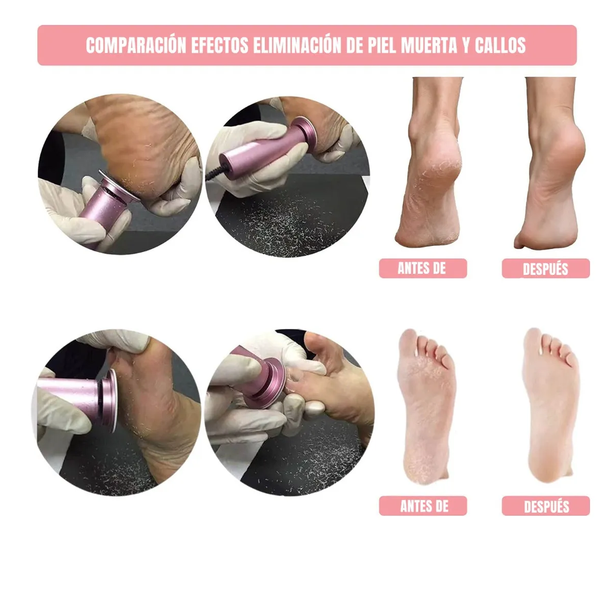 Foto 3 pulgar | Máquinas Exfoliadoras Removedor De Callos Lima Para Pies Eo Safe Imports Esi-19026 Negro