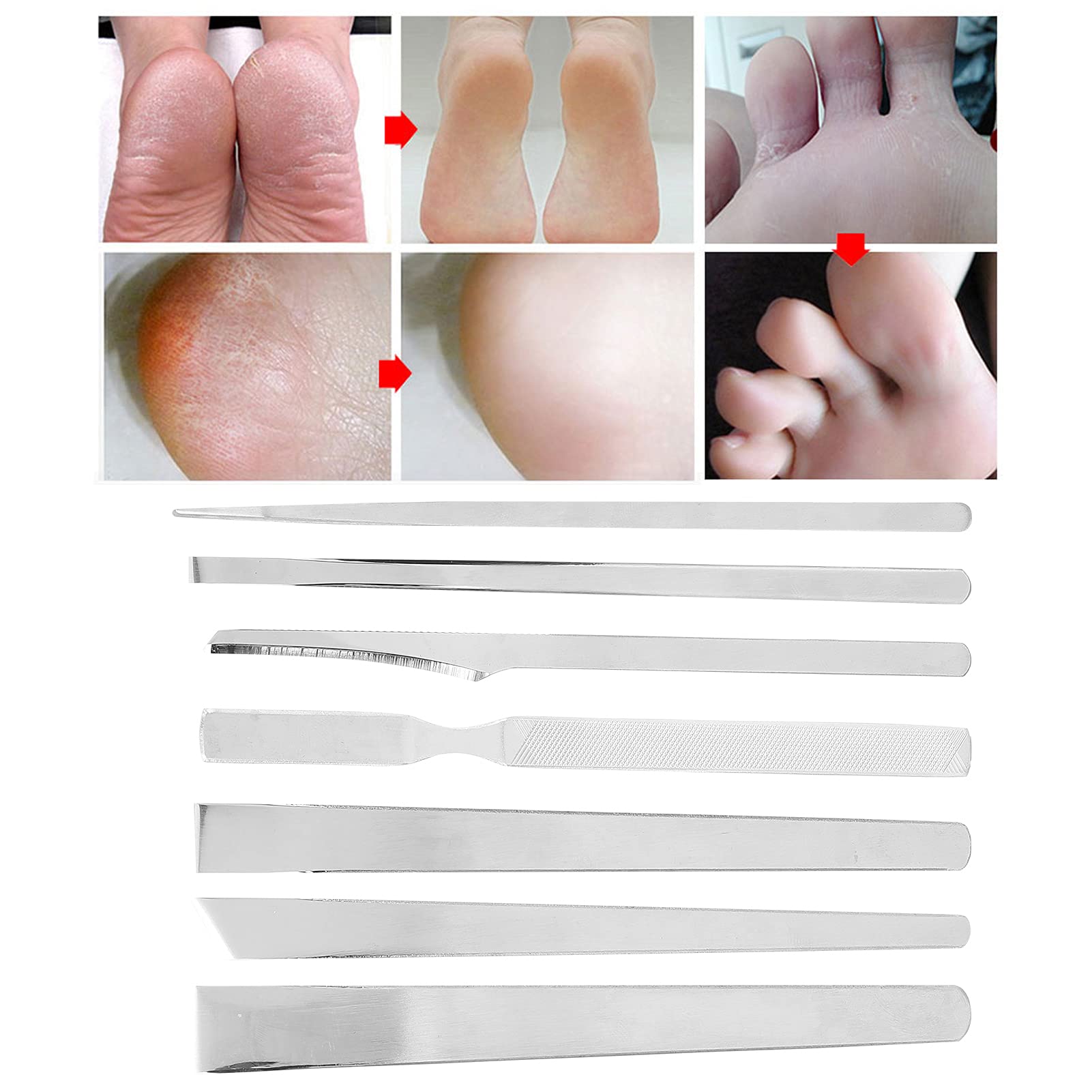 Foto 4 pulgar | Juego De Cuchillos De Pedicura Dioche Household Para Eliminar Uñas Encarnadas - Venta Internacional.
