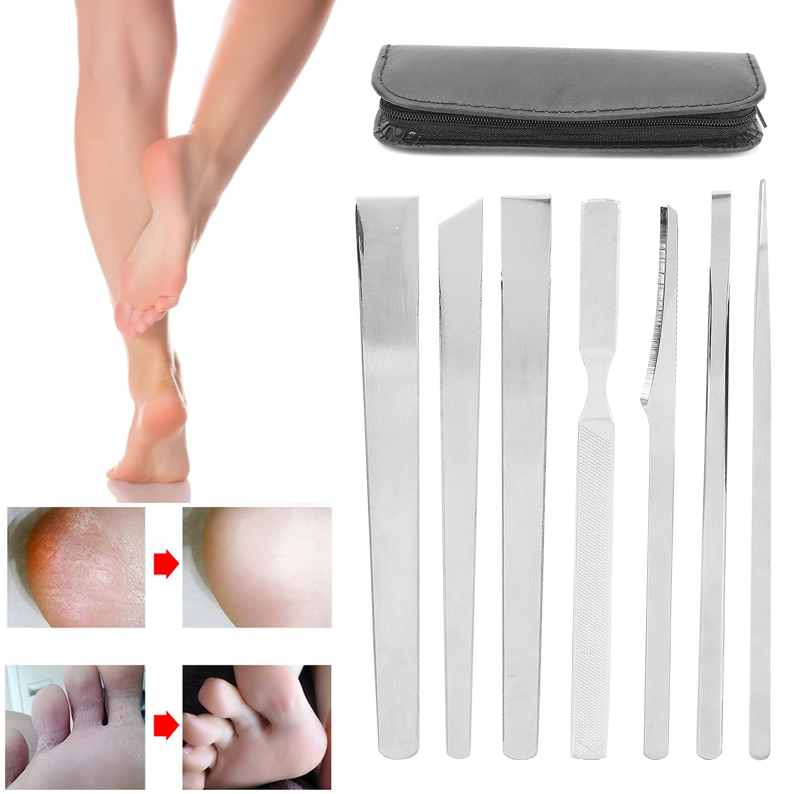 Foto 5 pulgar | Juego De Cuchillos De Pedicura Dioche Household Para Eliminar Uñas Encarnadas - Venta Internacional.
