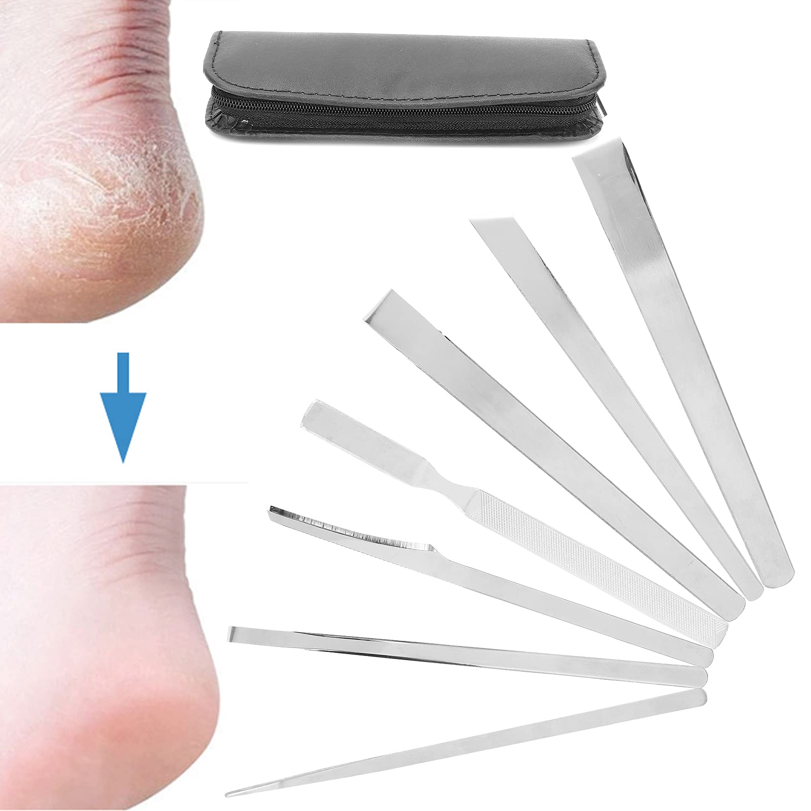 Foto 7 pulgar | Juego De Cuchillos De Pedicura Dioche Household Para Eliminar Uñas Encarnadas - Venta Internacional.