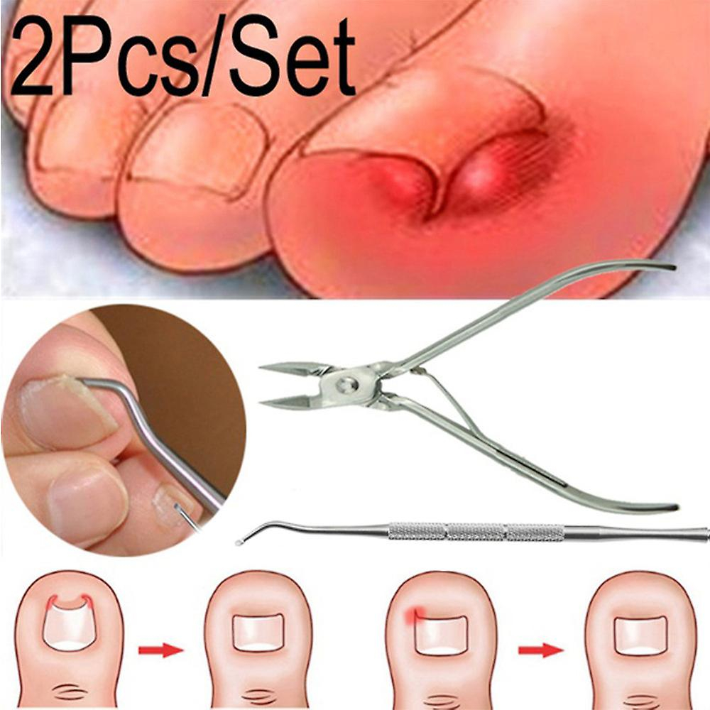 Foto 3 pulgar | Juego De Pinzas Correctoras De Uñas Encarnadas - Venta Internacional.