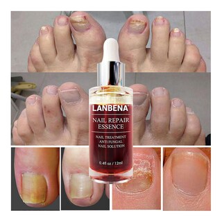Foto 2 | Blanqueador De Uñas Y Pies Nail Treatment Essence 12 Ml 2 Unidades - Venta Internacional.