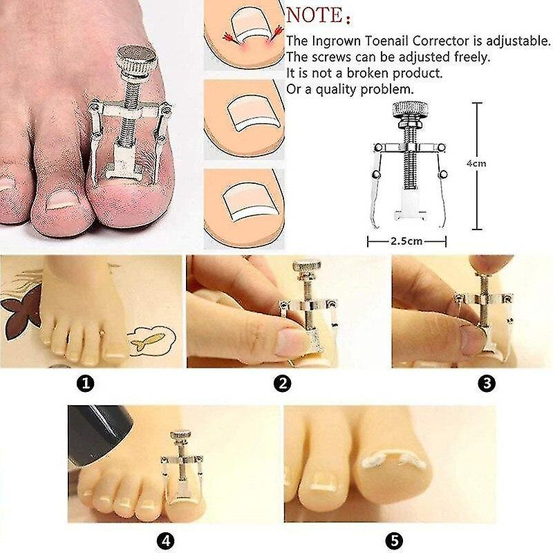 Foto 5 pulgar | Juego De Herramientas De Pedicura Huoguo  12 Limas Para Pies Encarnados - Venta Internacional.