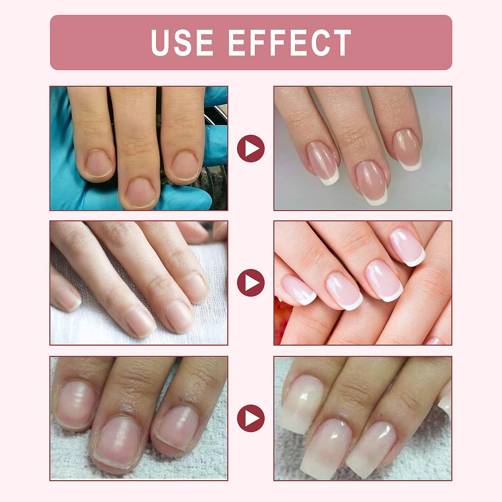 Foto 5 pulgar | Set De Gel Para Extensiones De Uñas Huoguo Crystal De 20 Ml Con Pegamento - Venta Internacional.