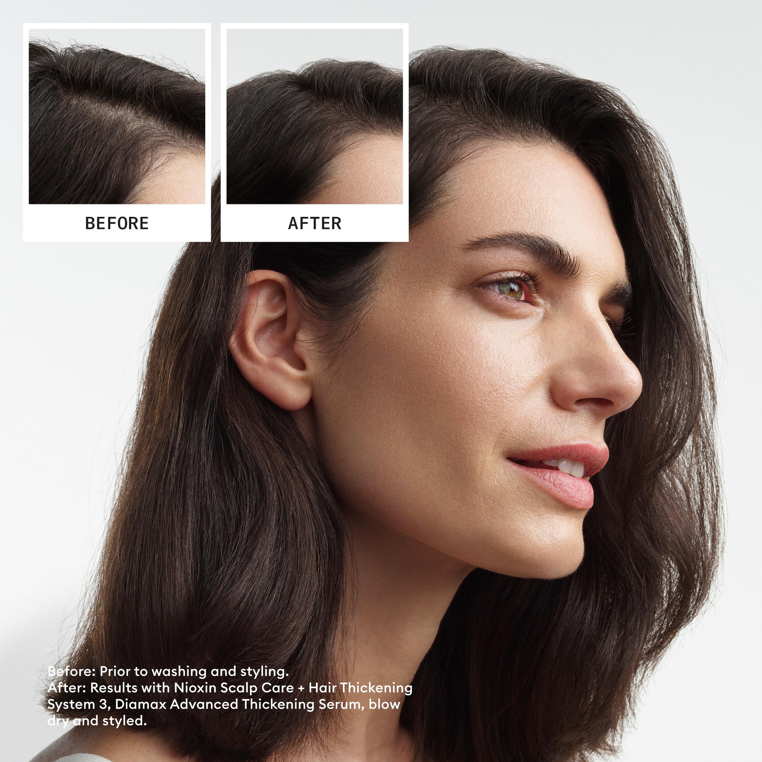 Foto 4 pulgar | Acondicionador Nioxin System 3 Para Cuero Cabelludo Y Cabello, 1 Litro, Para Cabello Teñido - Venta Internacional.