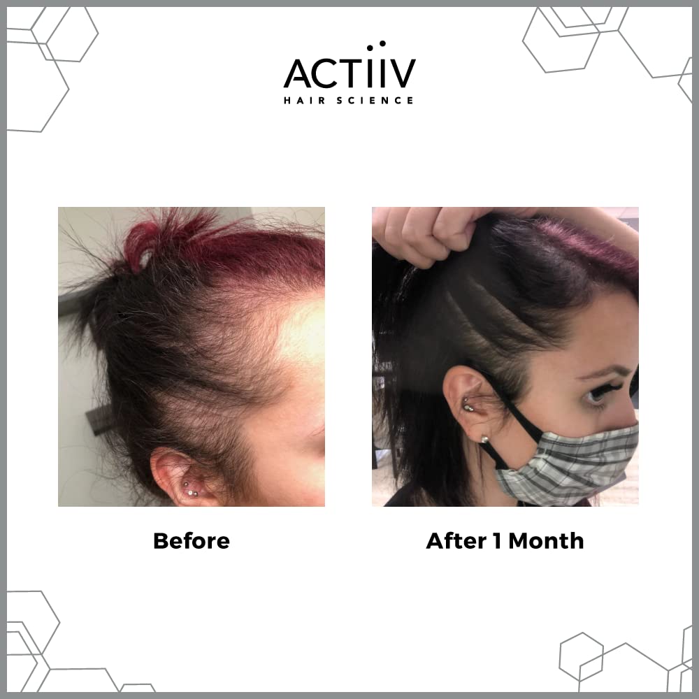 Foto 2 | Acondicionador Actiiv Recover Para Engrosar La Caída Del Cabello, 473 Ml - Venta Internacional.