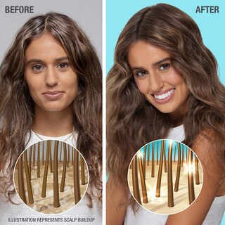 Foto 4 | Acondicionador Neutrogena Healthy Scalp Hydro Boost 355 Ml Para Cabello Seco - Venta Internacional.