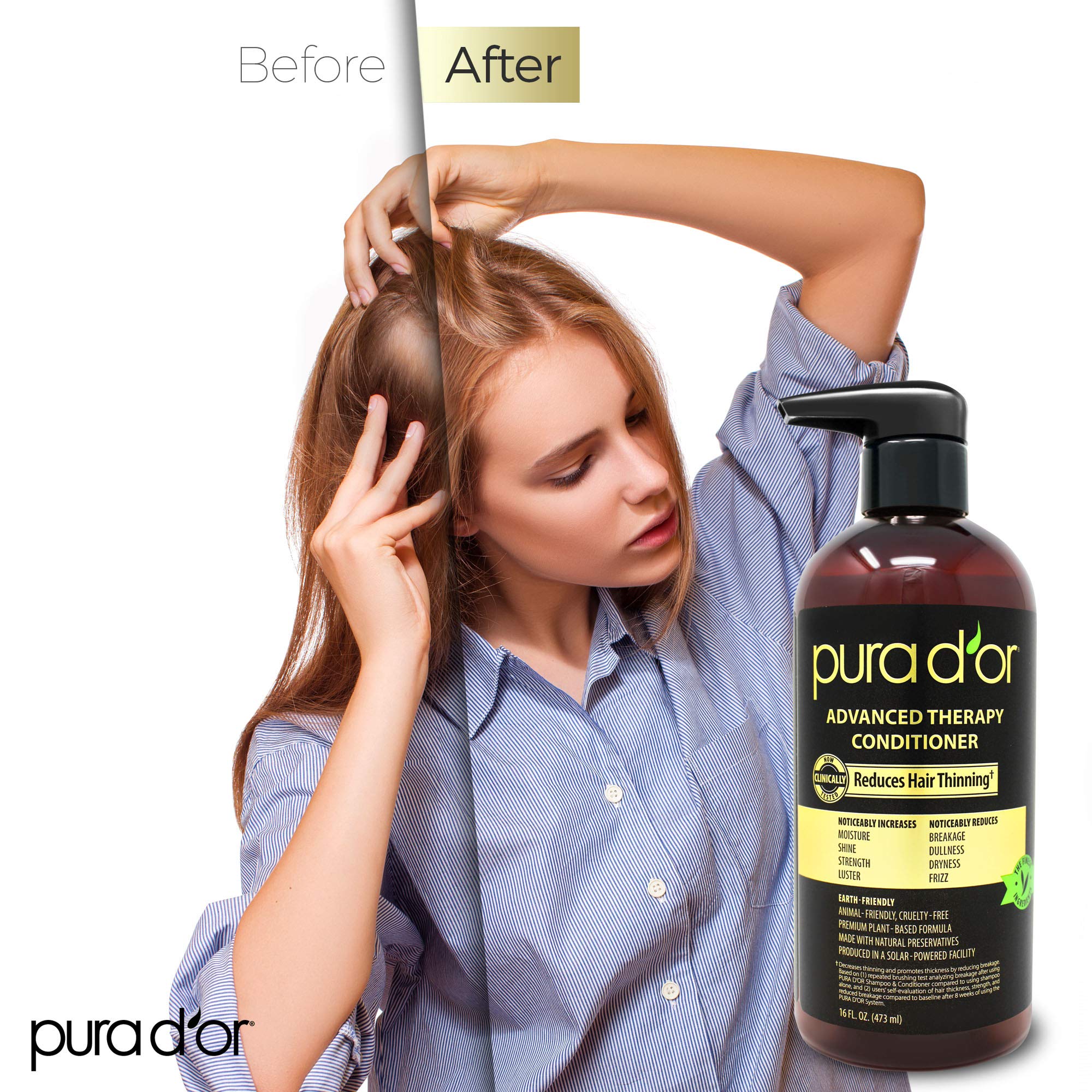Foto 4 pulgar | Acondicionador Pura D'or Advanced Therapy  473 Ml  Hidratación Y Volumen - Venta Internacional.