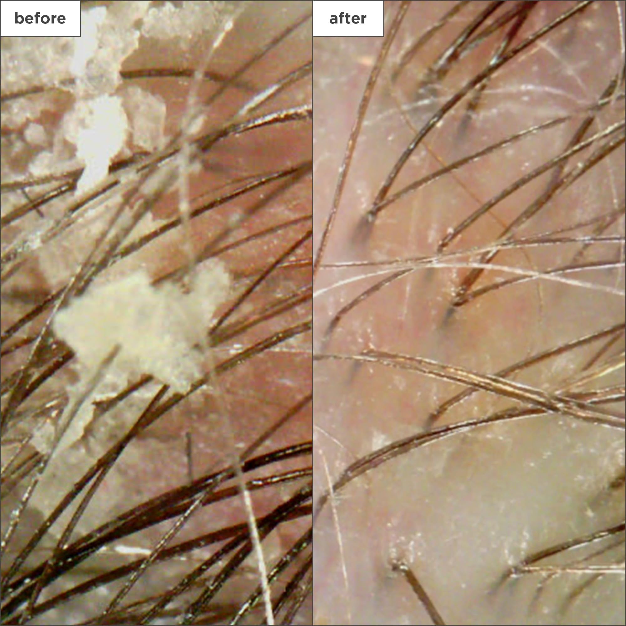 Foto 4 pulgar | Set De 4 Piezas Scalp Revival Soothe + Detoxify Minikit Briogeo - Venta Internacional.