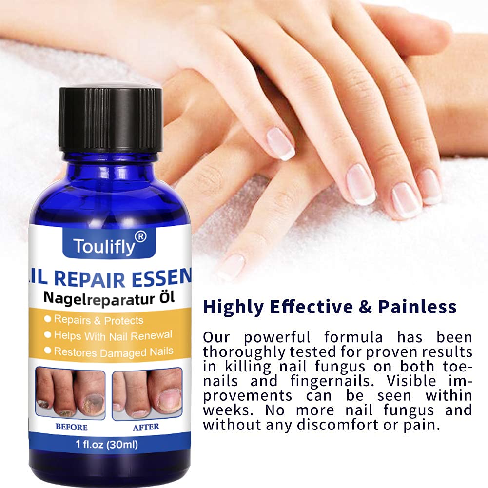 Foto 5 pulgar | Tratamiento Bump Control Nairobi Kool Player, 30 Ml - Venta Internacional.
