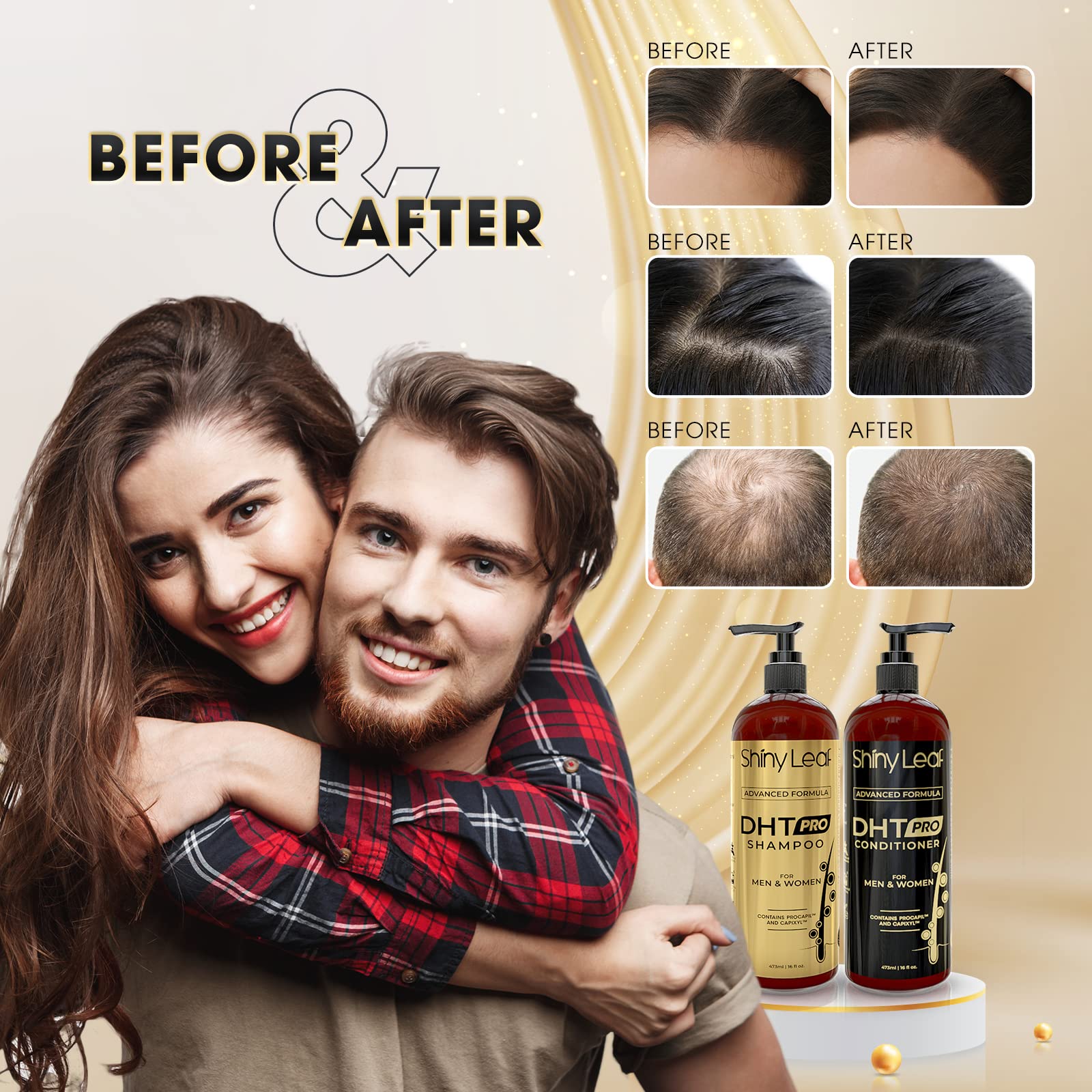 Foto 4 | Set De Champú Y Acondicionador Shiny Leaf Dht Pro Anticaída - Venta Internacional.