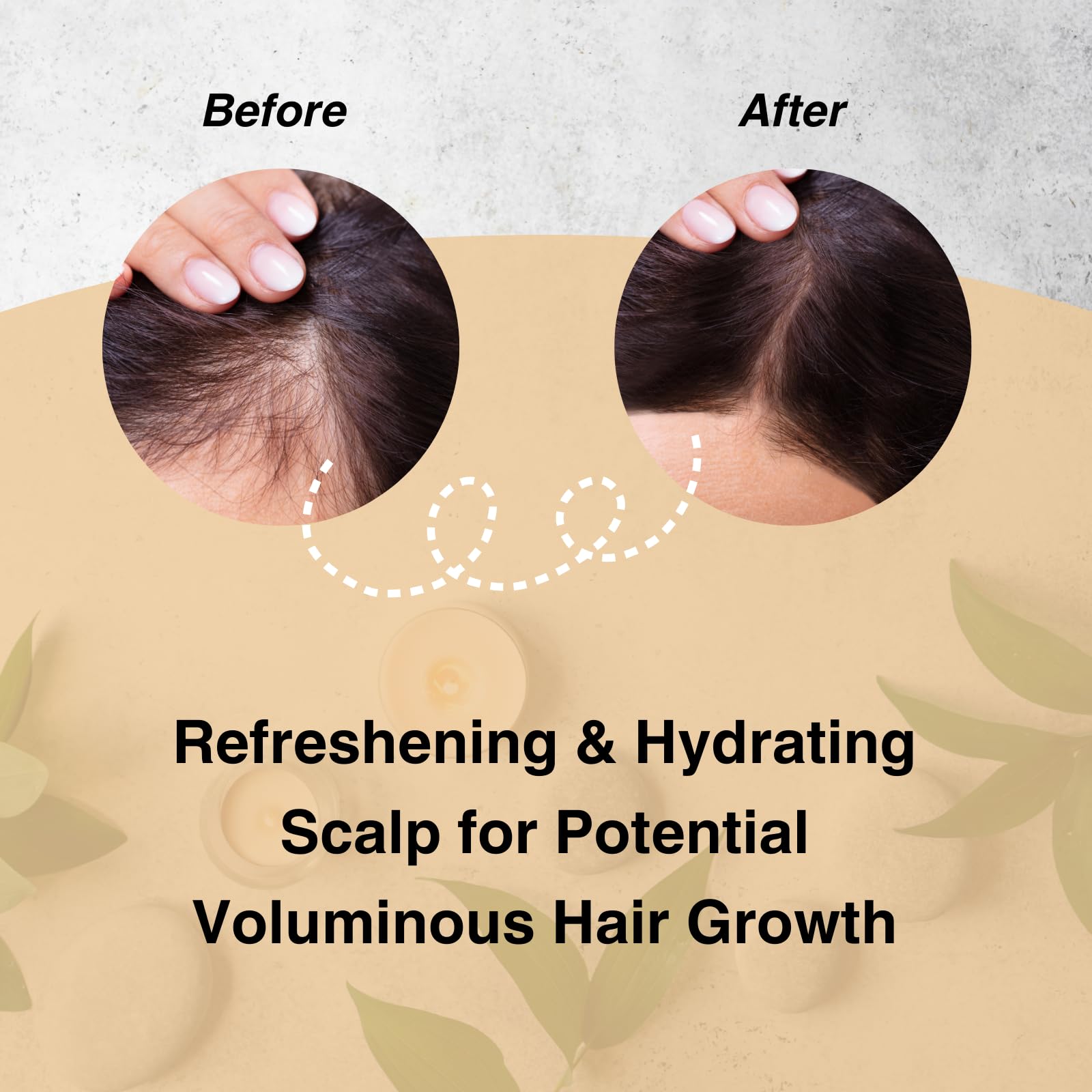 Foto 5 pulgar | Set De Champú Y Acondicionador Moist Diane Keratin Volume & Scalp - Venta Internacional.