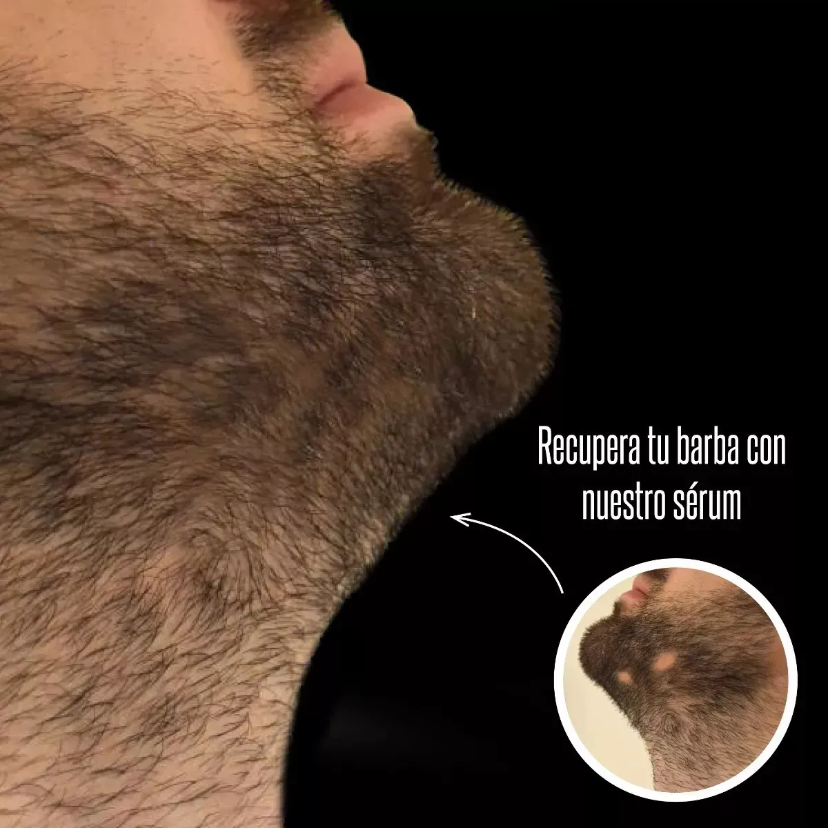 Foto 2 | Blackbeard 10% Tópico Para Crecimiento De Barba  2 Pz Lab.g Negro