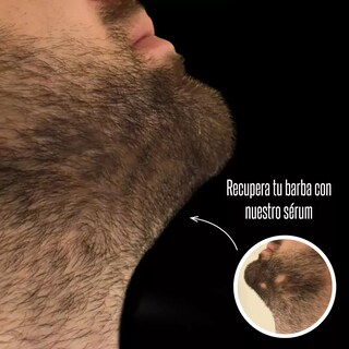 Foto 2 | Blackbeard 10% Tópico Para Crecimiento De Barba 2 Pz Lab.g Negro