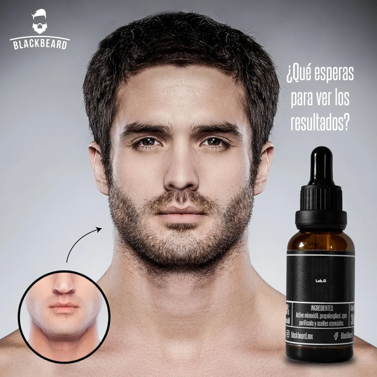 Foto 5 | Blackbeard 10% Tópico Para Crecimiento De Barba  2 Pz Lab.g Negro