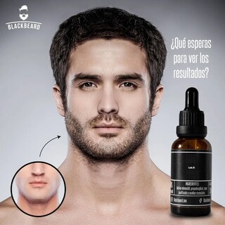 Foto 5 | Blackbeard 10% Tópico Para Crecimiento De Barba 2 Pz Lab.g Negro