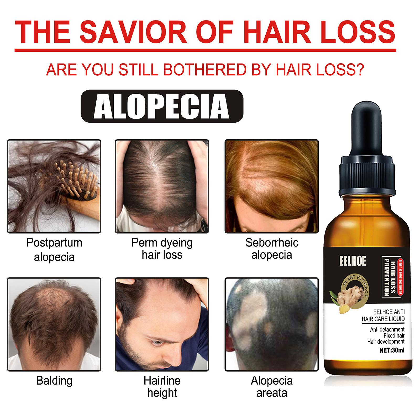 Foto 3 pulgar | Aceite Esencial Para El Crecimiento Del Cabello Huoguo Plant Anticaída  30 Ml - Venta Internacional.